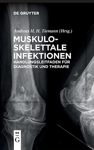 Muskuloskelettale Infektionen by Andreas Heinrich Tiemann ISBN 9783110473155