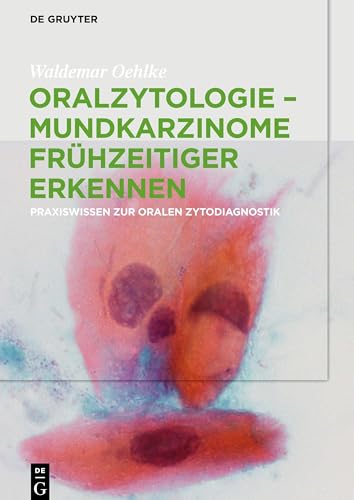 Oralzytologie - Mundkarzinome fruhzeitiger erkennen by Waldemar Oehlke ISBN 9783110627503