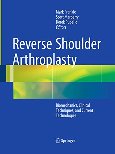 Reverse Shoulder Arthroplasty by Mark Frankle ISBN 9783319371535