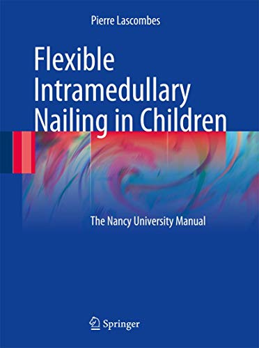 Flexible Intramedullary Nailing in Children by Pierre Lascombes | ISBN-13 9783642030307