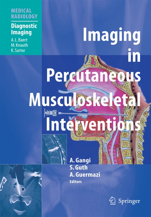 Imaging in Percutaneous Musculoskeletal Interventions by Afshin Gangi | ISBN-13 9783642060441