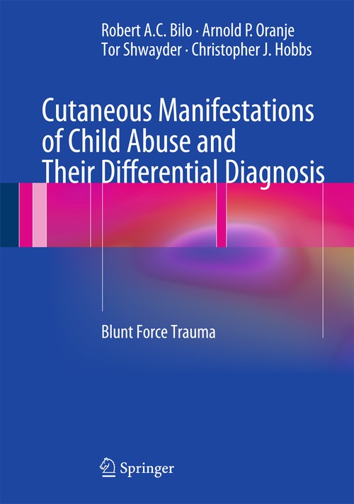 Cutaneous Manifestations of Child Abuse and Their Differential Diagnosis by Robert Ac Bilo | ISBN-13 9783642292866