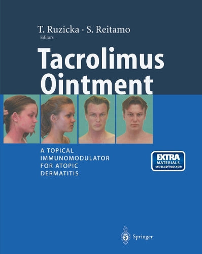 Tacrolimus Ointment by T Ruzicka | ISBN-13 9783662102114