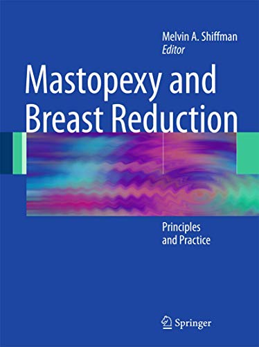 Mastopexy and Breast Reduction by Melvin A Shiffman | ISBN-13 9783662518571