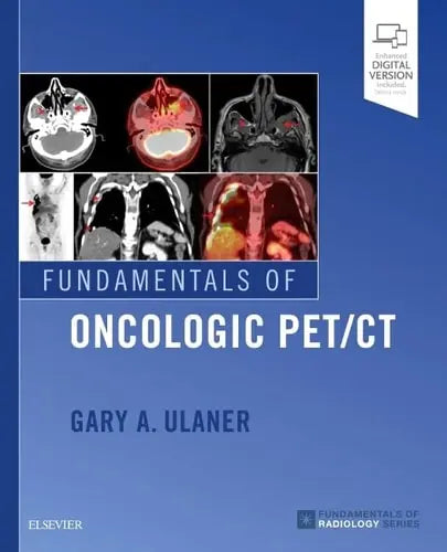 Fundamentals of Oncologic PET/CT by Gary A. Ulaner 1st Edition ISBN 9780323568692