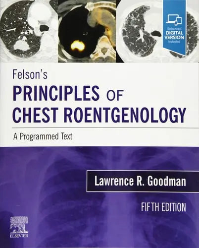 Felson's Principles of Chest Roentgenology A Programmed Text by Lawrence Roger Goodman 5th Edition ISBN 9780323625678