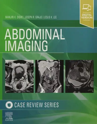 Abdominal Imaging Case Review Series by Manjiri Dighe 1st Edition ISBN 9780323679848 - front cover