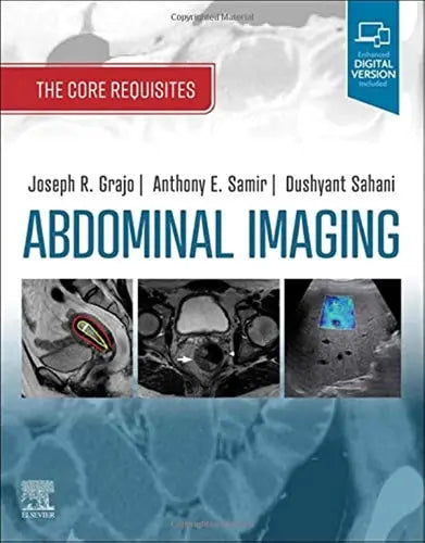 Abdominal Imaging The Core Requisites by Joseph R. Grajo 1st Edition ISBN 9780323680615