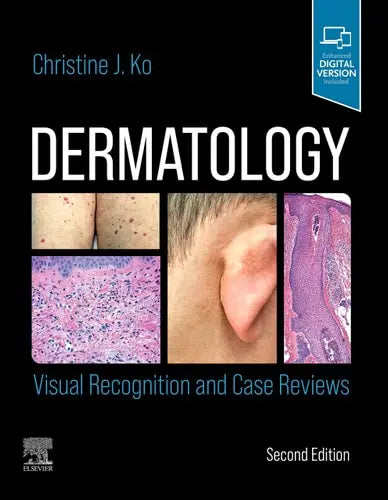 Dermatology Visual Recognition and Case Reviews by Christine J. Ko 2nd Edition ISBN 9780323697255