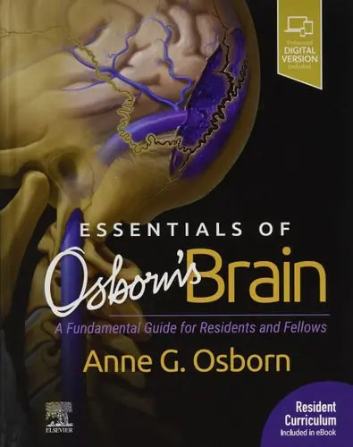 Essentials of Osborn's Brain A Fundamental Guide for Residents and Fellows by Anne G. Osborn 1st Edition ISBN 9780323713207