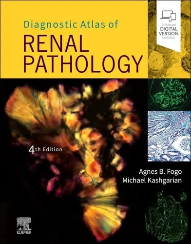 Diagnostic Atlas of Renal Pathology by Agnes B. Fogo 4th Edition ISBN 9780323721639