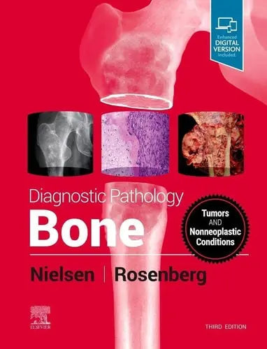 Diagnostic Pathology: Bone by G. Petur Nielsen 3rd Edition ISBN 9780323765336