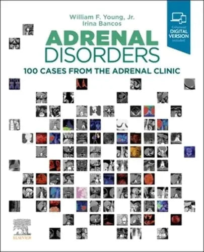 Adrenal Disorders 100 Cases from the Adrenal Clinic by Irina Bancos 1st Edition ISBN 9780323792851