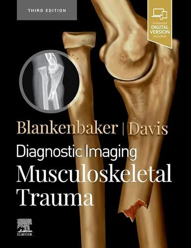 Diagnostic Imaging: Musculoskeletal Trauma by Donna G. Blankenbaker 3rd Edition ISBN 9780323793933
