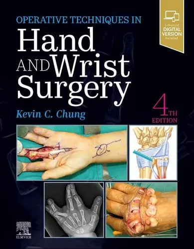 Operative Techniques: Hand and Wrist Surgery by Kevin C. Chung 4th Edition ISBN 9780323794152
