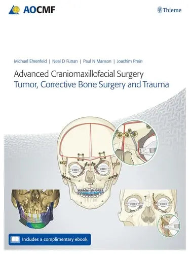 Advanced Craniomaxillofacial Surgery Tumor, Corrective Bone Surgery, and Trauma by Michael Ehrenfeld ISBN: 978-3132428393 - front cover