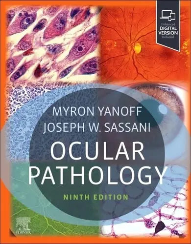 Ocular Pathology by Myron Yanoff 9th Edition ISBN 9780323878227