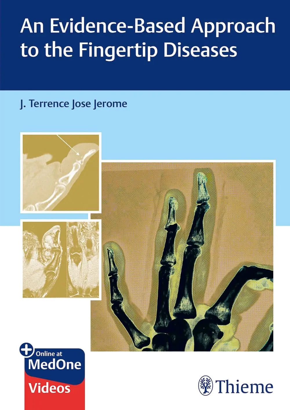 An Evidence-Based Approach to the Fingertip Diseases by J. Terrence Jerome 1st Edition - front cover