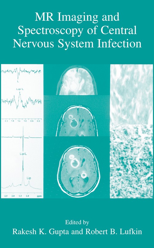 MR Imaging and Spectroscopy of Central Nervous System Infection by Rakesh K Gupta ISBN 9780306465512