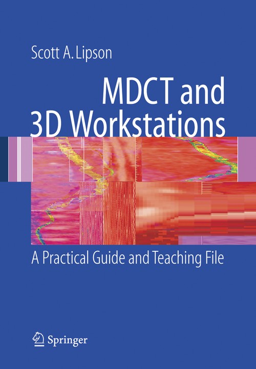 MDCT and 3D Workstations by Scott A Lipson ISBN 9780387256795