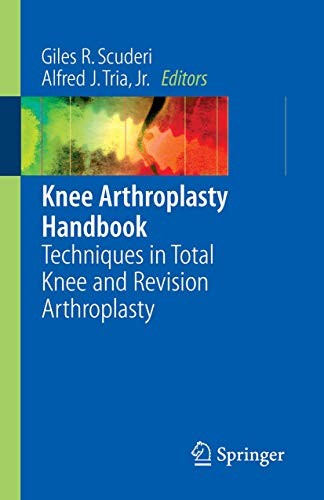 Knee Arthroplasty Handbook by Giles R Scuderi Md ISBN 9780387307305