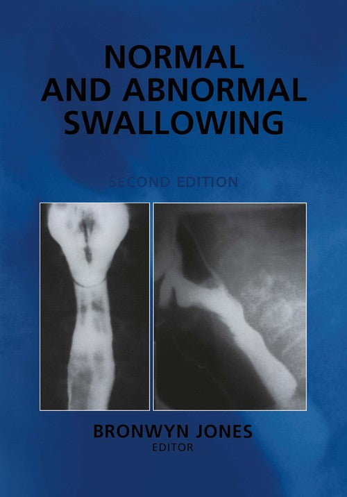 Normal and Abnormal Swallowing by Bronwyn Jones ISBN 9780387951942