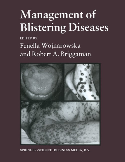 Management of Blistering Diseases by Robert A Briggaman Fenella Wojnarowska ISBN 9780412289903