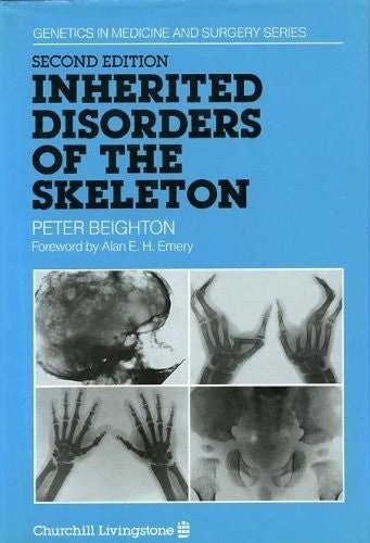 Inherited Disorders of the Skeleton by Peter Beighton 9780443035067