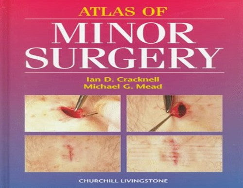 Atlas of Minor Surgery by Ian D Cracknell 9780443053047