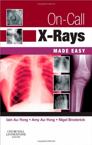 On-Call X-Rays Made Easy by Iain Au-Yong Ma Bmbch Mrcs Frcr ISBN 9780702034459