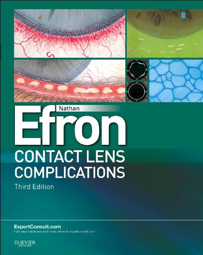 Contact Lens Complications by Nathan Efron Bscoptom Dsc Faao Fiacle Fcclsa Fbcla Faco ISBN 9780702042690