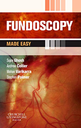 Fundoscopy Made Easy by Sujoy Ghosh Md Dm Mrcp Mrcps ISBN 9780702042973