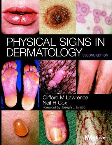 Physical Signs in Dermatology by Clifford M Lawrence ISBN 9780723431848