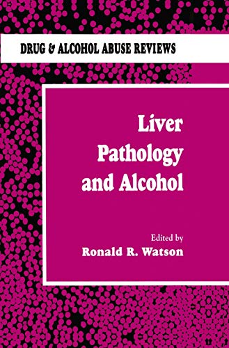 Liver Pathology and Alcohol by Roland R Watson ISBN 9780896032064