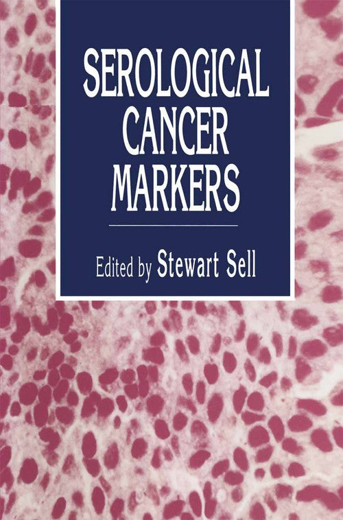 Serological Cancer Markers by Stewart Sell ISBN 9780896032095