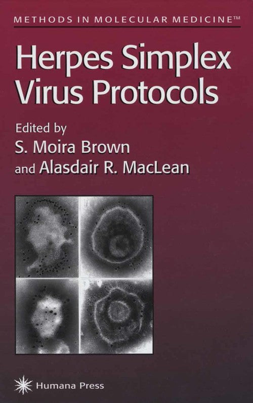 Herpes Simplex Virus Protocols by S Moira Brown 9780896033474