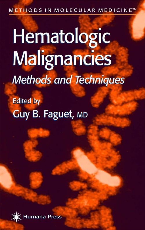 Hematologic Malignancies by Guy B Faguet ISBN 9780896035430