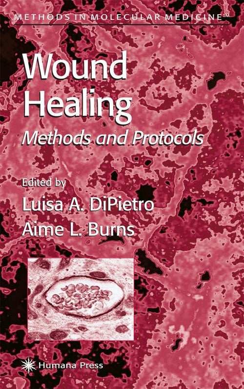 Wound Healing by Luisa A Dipietro ISBN 9780896039995