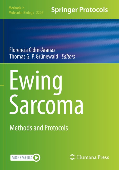 Ewing Sarcoma by Florencia Cidre-Aranaz ISBN 9781071610190
