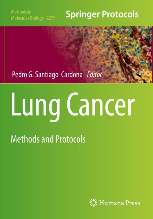 Lung Cancer by Pedro G Santiago-Cardona ISBN 9781071612804
