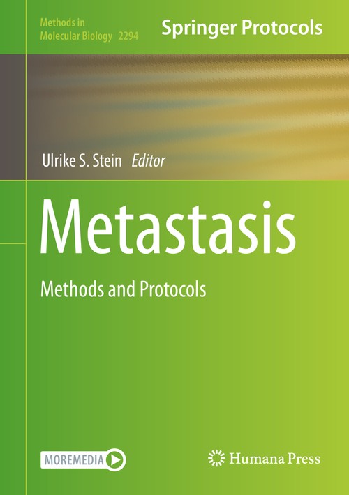 Metastasis by Ulrike S Stein ISBN 9781071613498