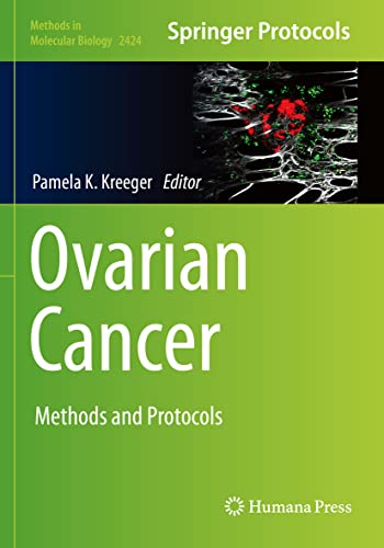 Ovarian Cancer by Pamela K Kreeger ISBN 9781071619582