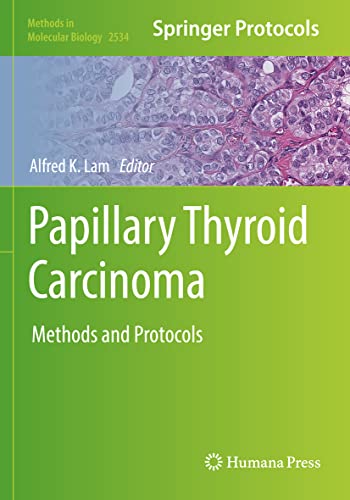 Papillary Thyroid Carcinoma by Alfred K Lam ISBN 9781071625071