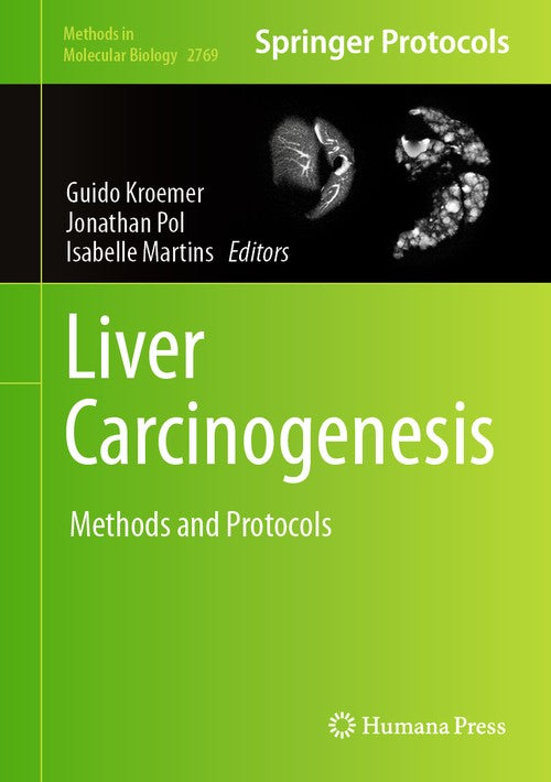 Liver Carcinogenesis by Guido Kroemer ISBN 9781071636930