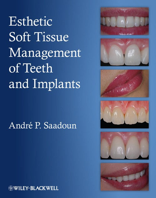 Esthetic Soft Tissue Management of Teeth and Implants by Andre P Saadoun ISBN 9781118301159