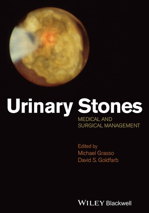 Urinary Stones by Michael Grasso ISBN 9781118405437