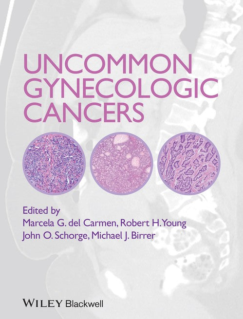 Uncommon Gynecologic Cancers by Marcela Del Carmen ISBN 9781118655351