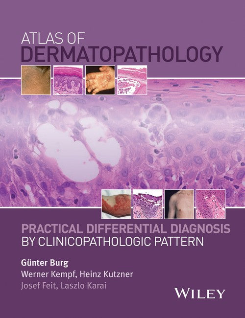 Atlas of Dermatopathology by Burg ISBN 9781118658314