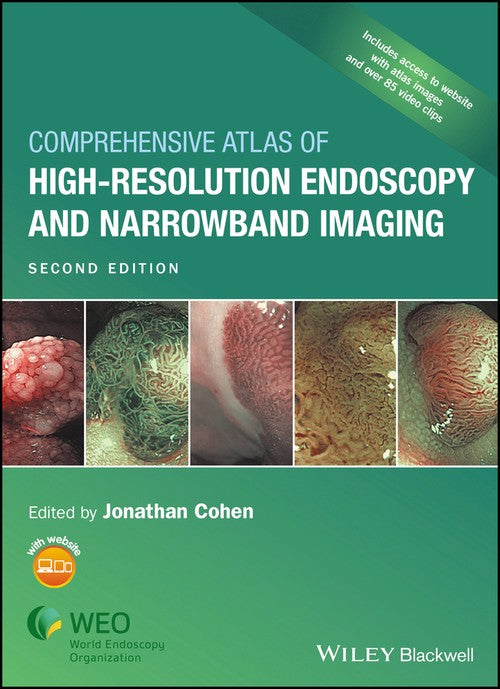 Comprehensive Atlas of High-Resolution Endoscopy and Narrowband Imaging by Jonathan Cohen ISBN 9781118705933