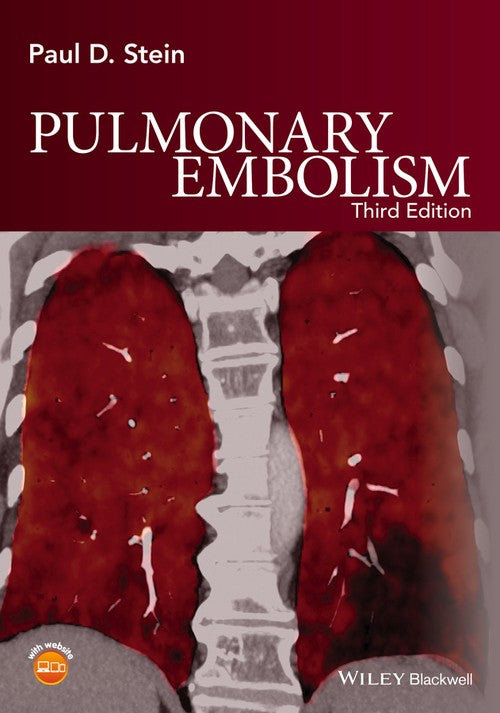 Pulmonary Embolism by Paul D Stein ISBN 9781119039082